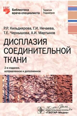 Дисплазия соединительной ткани
