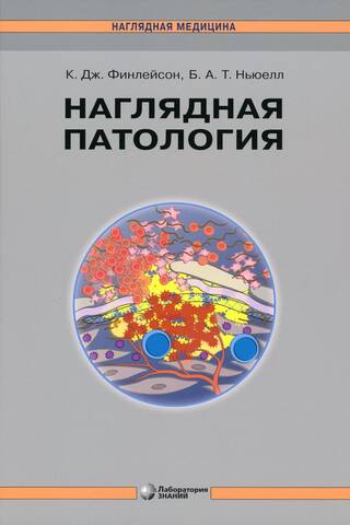 Наглядная патология